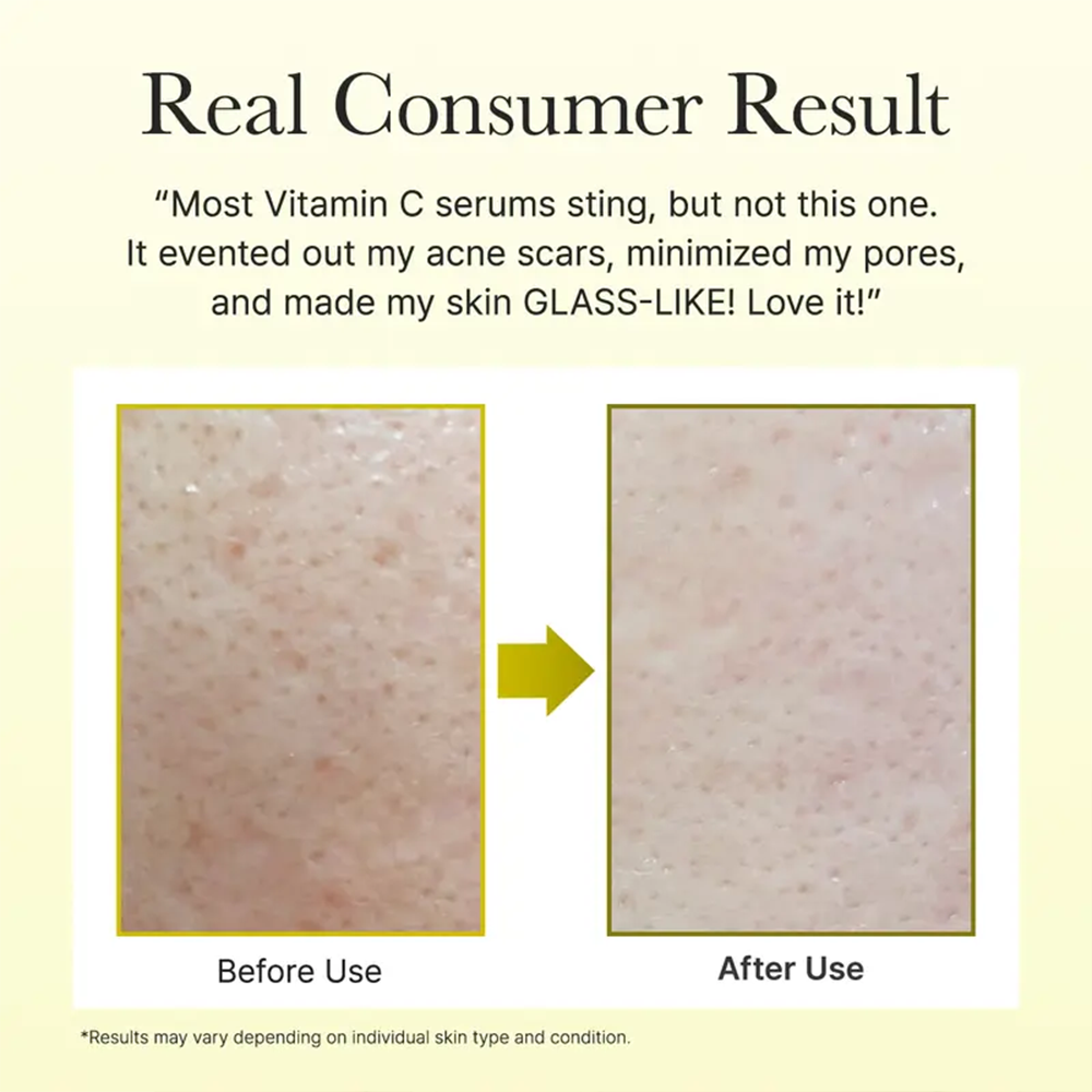Vitamin C Booster Shot, Pure Vitamin C + Glutathione for Bright, Healthy Skin Glow
